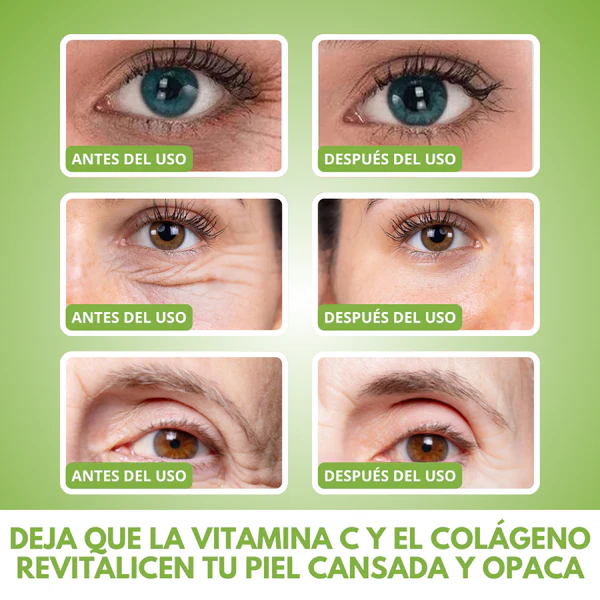 BEAUTY PATCH® - PACK ANTIARRUGAS CON COLÁGENO HIDROLIZADO 100% EFECTIVO