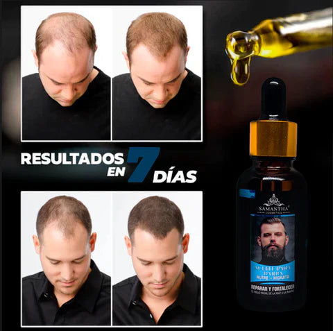 KASOMO™ - ESTIMULADOR CAPILAR y BARBA PREMIUM