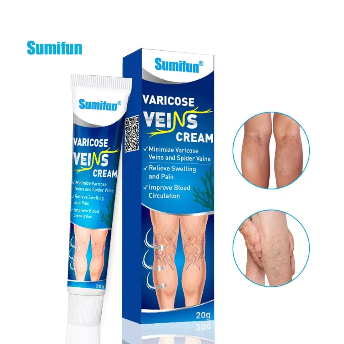 Crema de Venas Varicosas™- Tratamiento para combatir las varices