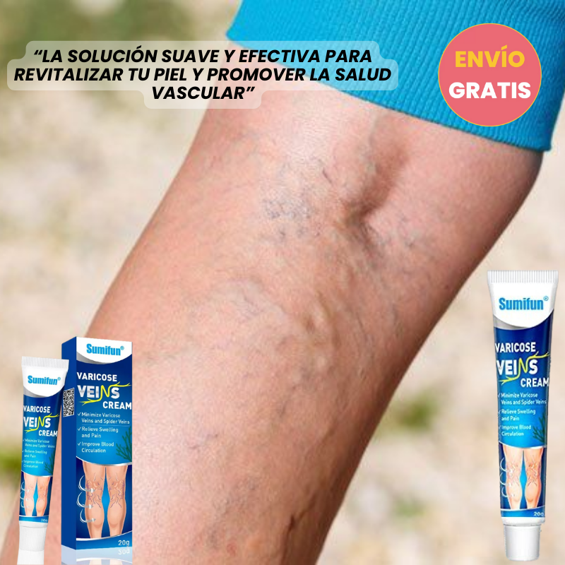 Crema de Venas Varicosas™- Tratamiento para combatir las varices